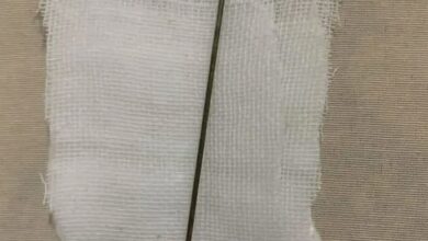 الإبرة التي استخرها الطبيب