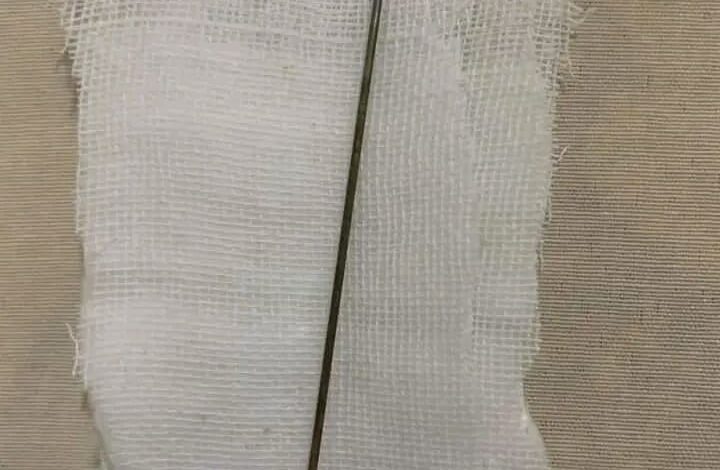 الإبرة التي استخرها الطبيب